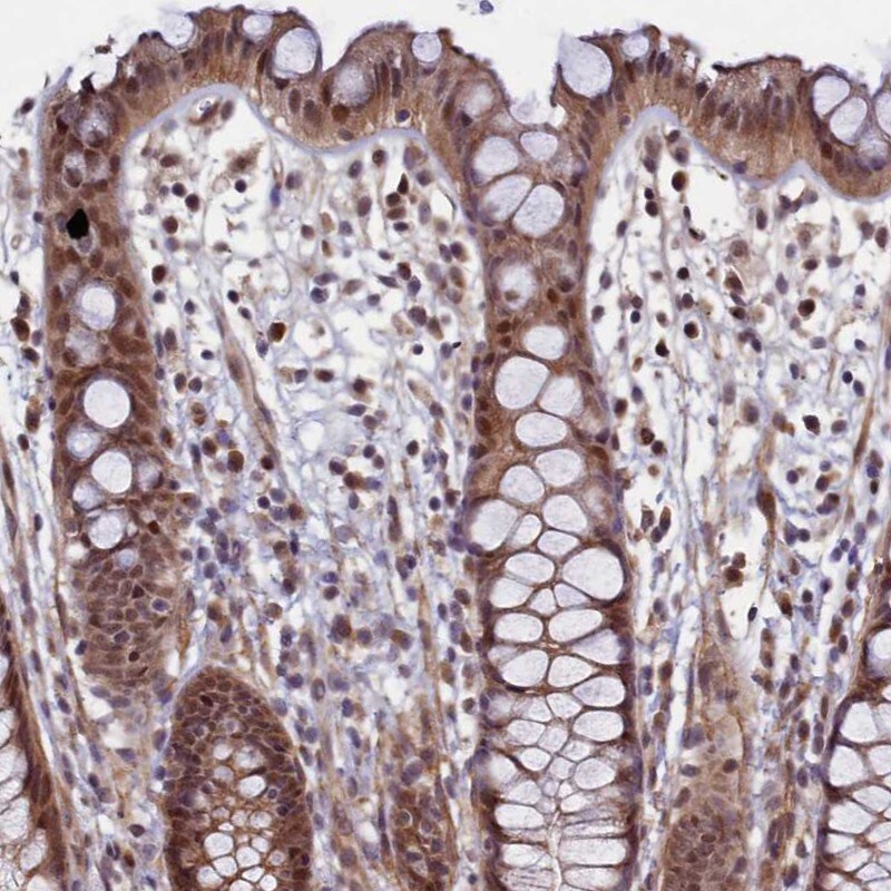 LEO1 Antibody - BSA Free Immunohistochemistry: LEO1 Antibody - BSA Free [NBP1-86236]