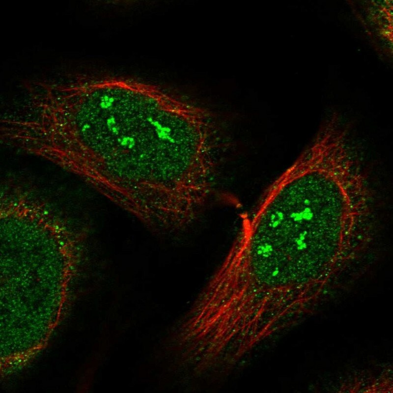 N4BP1 Antibody - BSA Free Immunocytochemistry/ Immunofluorescence: N4BP1 Antibody [NBP1-86238]