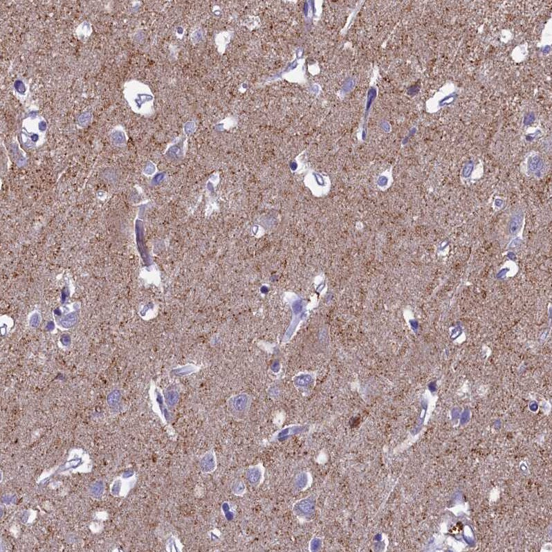 SV2C Antibody - BSA Free Immunohistochemistry: SV2C Antibody - BSA Free [NBP1-86239]
