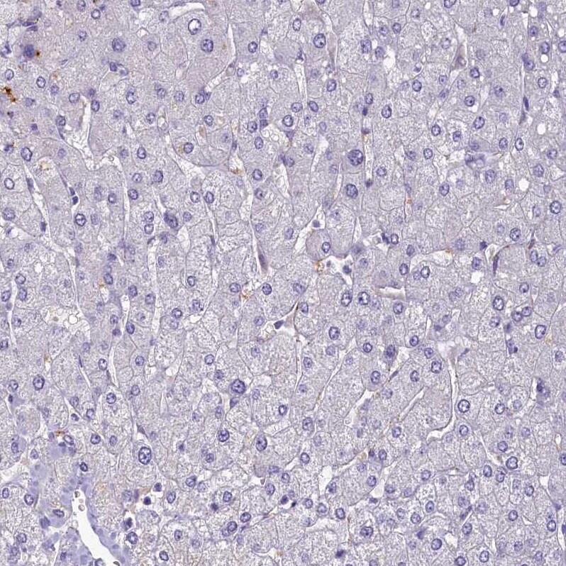 SV2C Antibody - BSA Free Immunohistochemistry: SV2C Antibody - BSA Free [NBP1-86239]