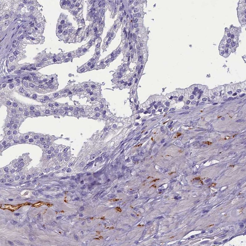 SV2C Antibody - BSA Free Immunohistochemistry: SV2C Antibody - BSA Free [NBP1-86239]
