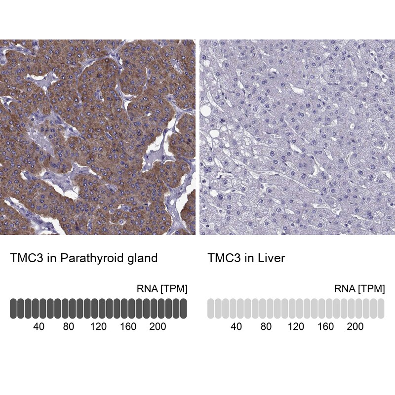 TMC3 Antibody - BSA Free Immunohistochemistry-Paraffin: TMC3 Antibody [NBP1-86240]