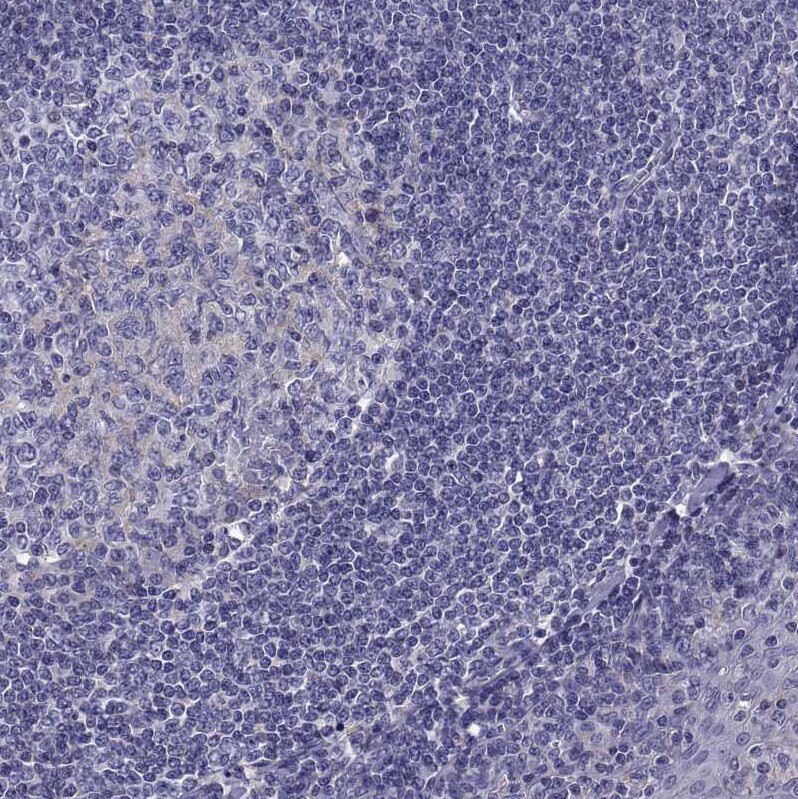 TMC3 Antibody - BSA Free Immunohistochemistry-Paraffin: TMC3 Antibody [NBP1-86240]