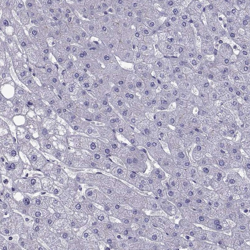 TMC3 Antibody - BSA Free Immunohistochemistry-Paraffin: TMC3 Antibody [NBP1-86240]