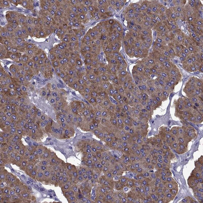 TMC3 Antibody - BSA Free Immunohistochemistry-Paraffin: TMC3 Antibody [NBP1-86240]