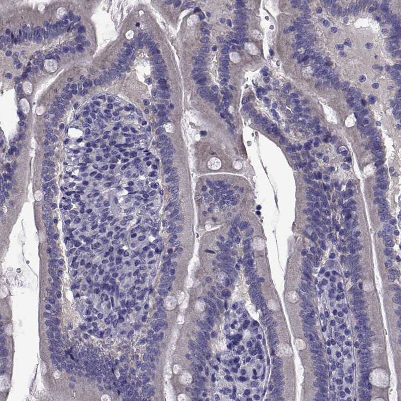 TMC3 Antibody - BSA Free Immunohistochemistry-Paraffin: TMC3 Antibody [NBP1-86240]