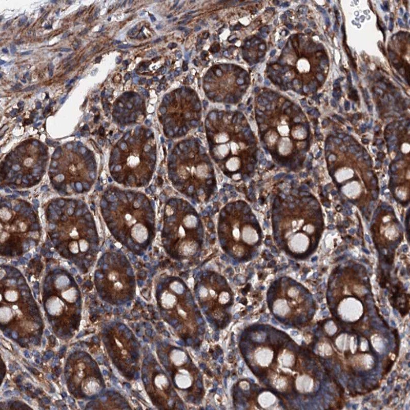 MOS Antibody - BSA Free Immunohistochemistry-Paraffin: MOS Antibody [NBP1-86241]