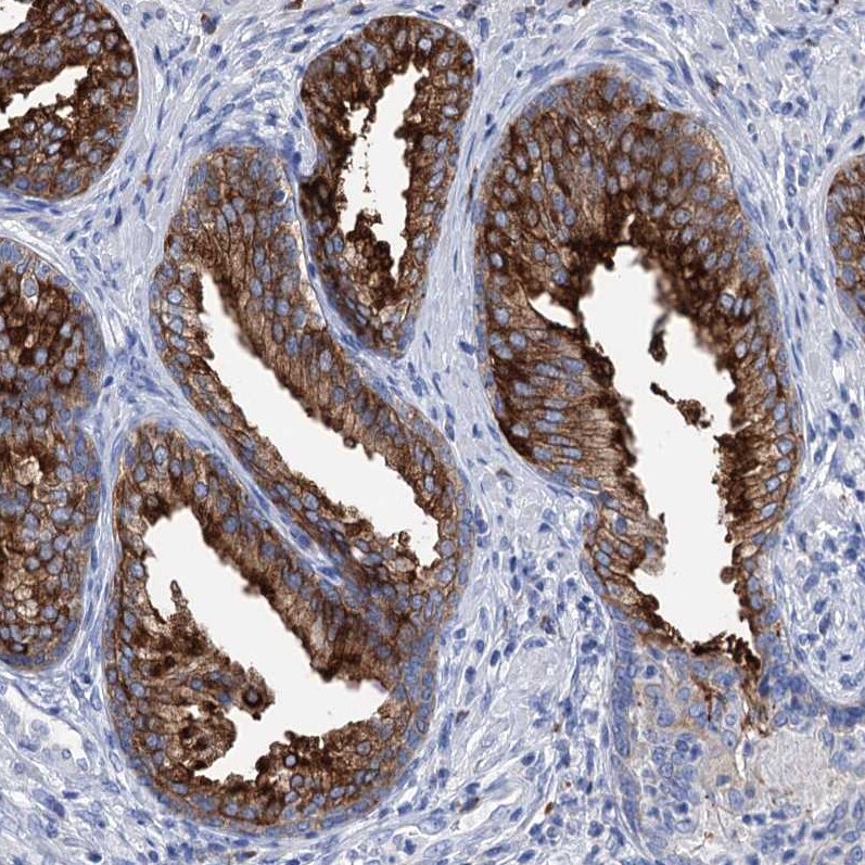 BBS4 Antibody - BSA Free Immunohistochemistry-Paraffin: BBS4 Antibody - BSA Free [NBP1-86248]