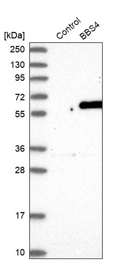 BBS4 Antibody - BSA Free Western Blot: BBS4 Antibody - BSA Free [NBP1-86248]