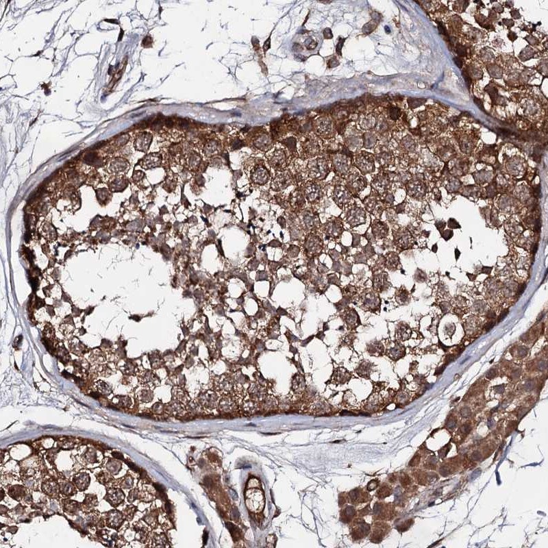 TEX9 Antibody - BSA Free Immunohistochemistry-Paraffin: TEX9 Antibody [NBP1-86249]