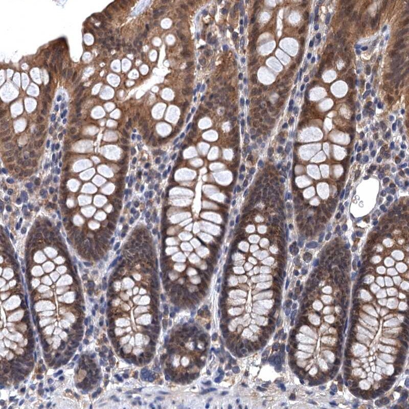 LRRC2 Antibody - BSA Free Immunohistochemistry: LRRC2 Antibody [NBP1-86250]