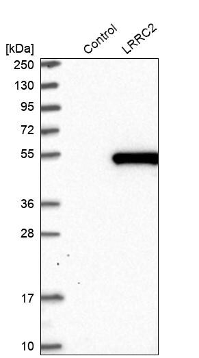 LRRC2 Antibody - BSA Free Western Blot: LRRC2 Antibody - BSA Free [NBP1-86250]