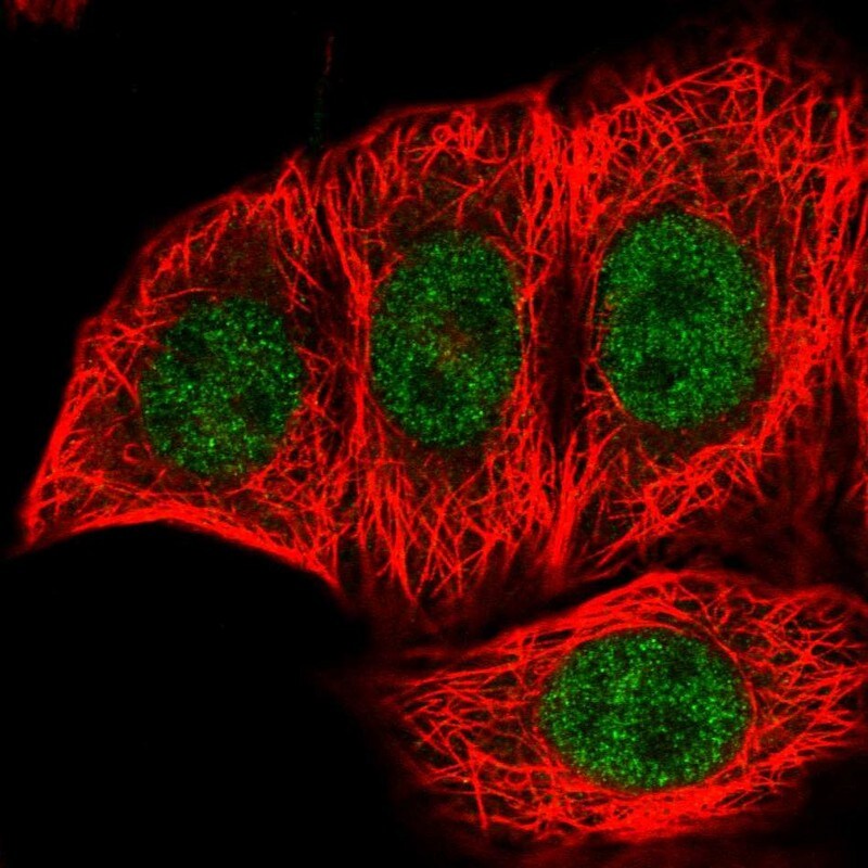 FANK1 Antibody - BSA Free Immunohistochemistry-Paraffin: FANK1 Antibody - BSA Free [NBP1-86258]