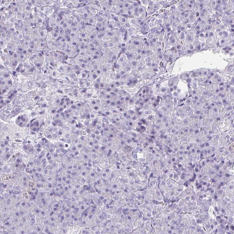 CREG2 Antibody - BSA Free Immunohistochemistry: CREG2 Antibody - BSA Free [NBP1-86262]