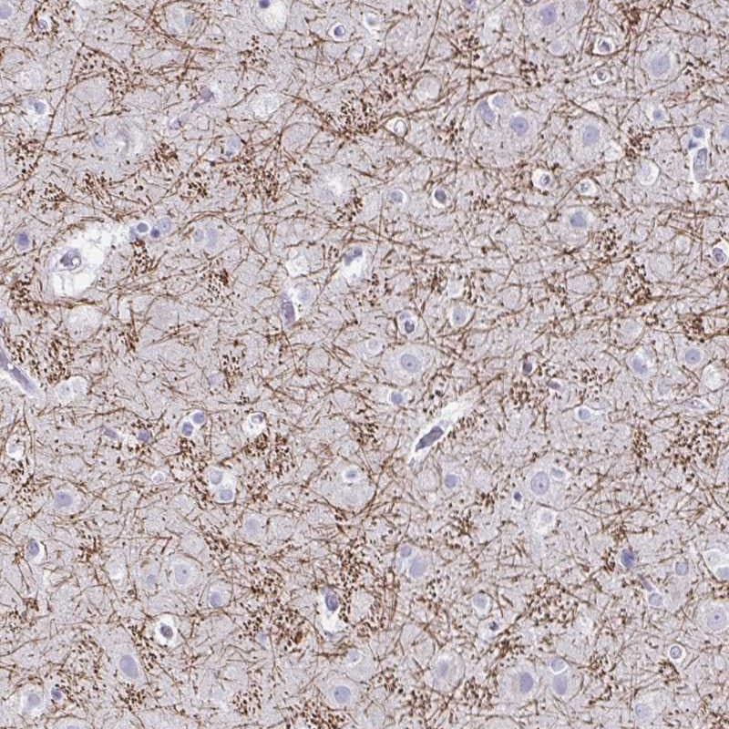 CREG2 Antibody - BSA Free Immunohistochemistry: CREG2 Antibody - BSA Free [NBP1-86262]