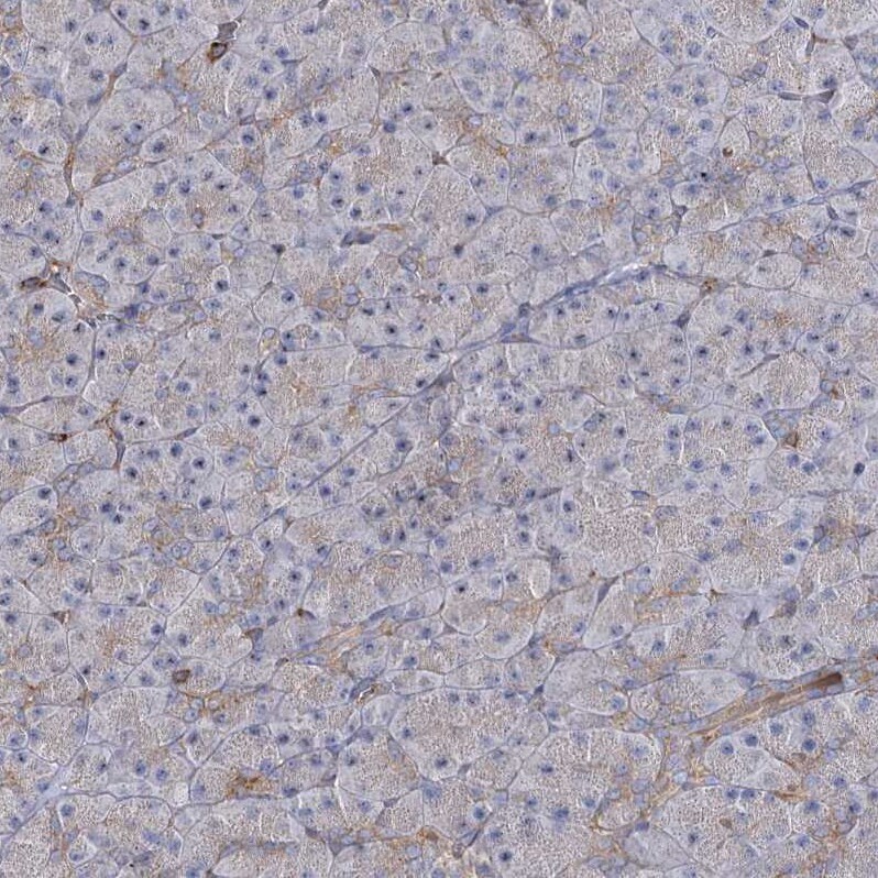 SEC24B Antibody - BSA Free Immunohistochemistry-Paraffin: SEC24B Antibody - BSA Free [NBP1-86263]
