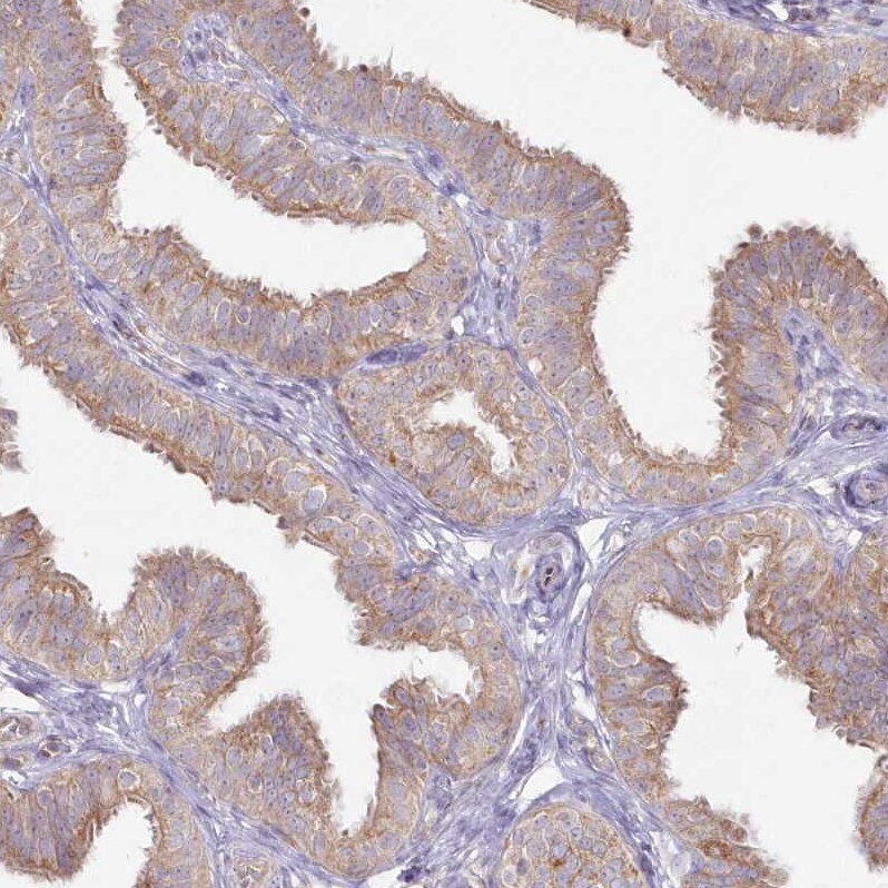 Arylsulfatase B/ARSB Antibody - BSA Free Immunohistochemistry-Paraffin: Arylsulfatase B/ARSB Antibody - BSA Free [NBP1-86270]