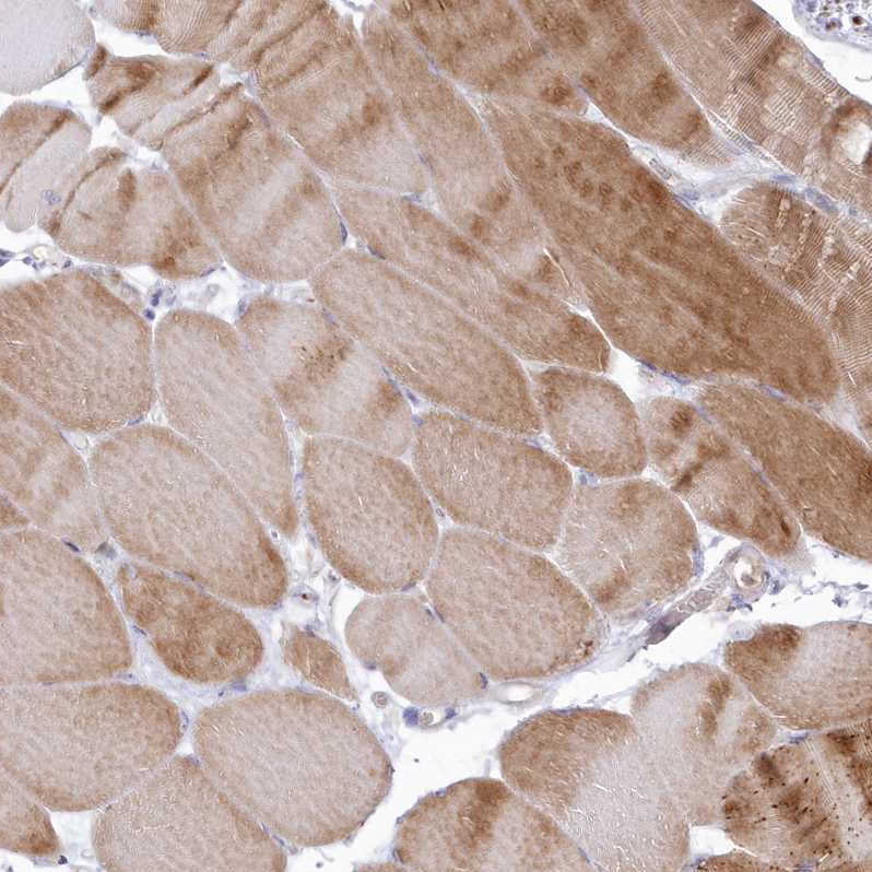Arylsulfatase B/ARSB Antibody - BSA Free Immunohistochemistry-Paraffin: Arylsulfatase B/ARSB Antibody - BSA Free [NBP1-86270]
