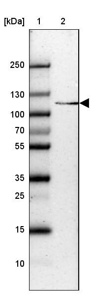 SH3BP4 Antibody - BSA Free Western Blot: SH3BP4 Antibody - BSA Free [NBP1-86274]