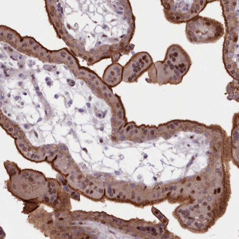 RNPEPL1 Antibody - BSA Free Immunohistochemistry-Paraffin: RNPEPL1 Antibody [NBP1-86282]