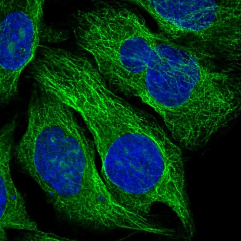 TBCA Antibody - BSA Free Immunohistochemistry-Paraffin: TBCA Antibody - BSA Free [NBP1-86288]