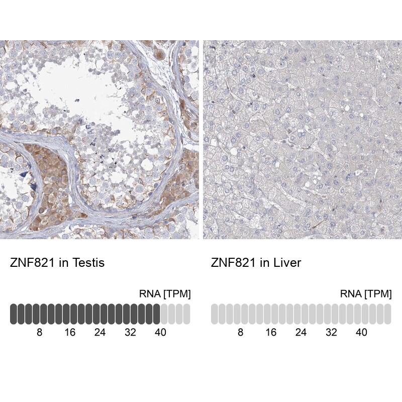 ZNF821 Antibody - BSA Free Immunohistochemistry-Paraffin: ZNF821 Antibody [NBP1-86290]