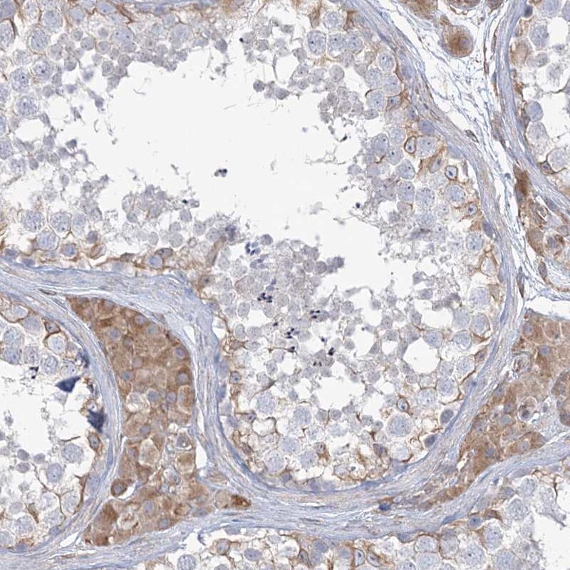 ZNF821 Antibody - BSA Free Immunohistochemistry-Paraffin: ZNF821 Antibody [NBP1-86290]