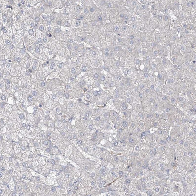 ZNF821 Antibody - BSA Free Immunohistochemistry-Paraffin: ZNF821 Antibody [NBP1-86290]