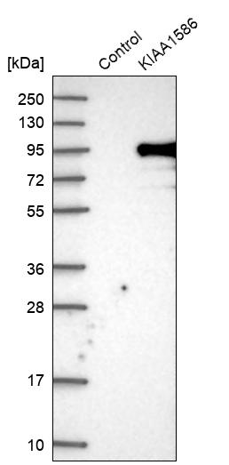 KIAA1586 Antibody - BSA Free Western Blot: KIAA1586 Antibody - BSA Free [NBP1-86291]