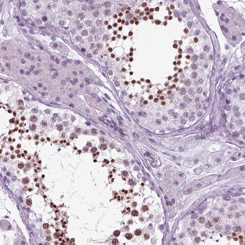 RFX3 Antibody - BSA Free Immunohistochemistry-Paraffin: RFX3 Antibody - BSA Free [NBP1-86301]