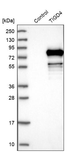 TIGD4 Antibody - BSA Free Western Blot: TIGD4 Antibody - BSA Free [NBP1-86303]