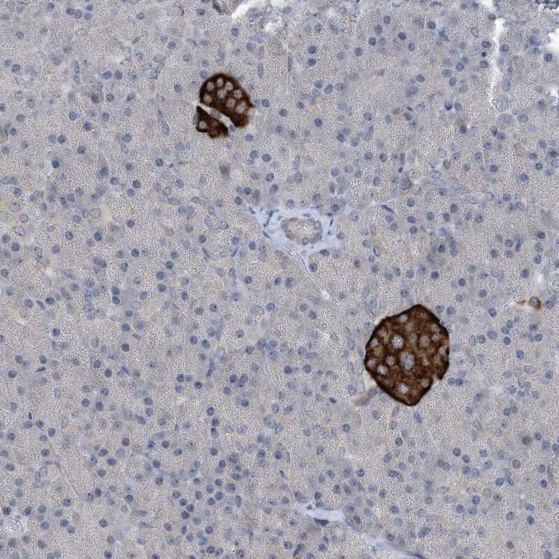 TIN-Ag Antibody - BSA Free Immunohistochemistry-Paraffin: TIN-Ag Antibody [NBP1-86307]