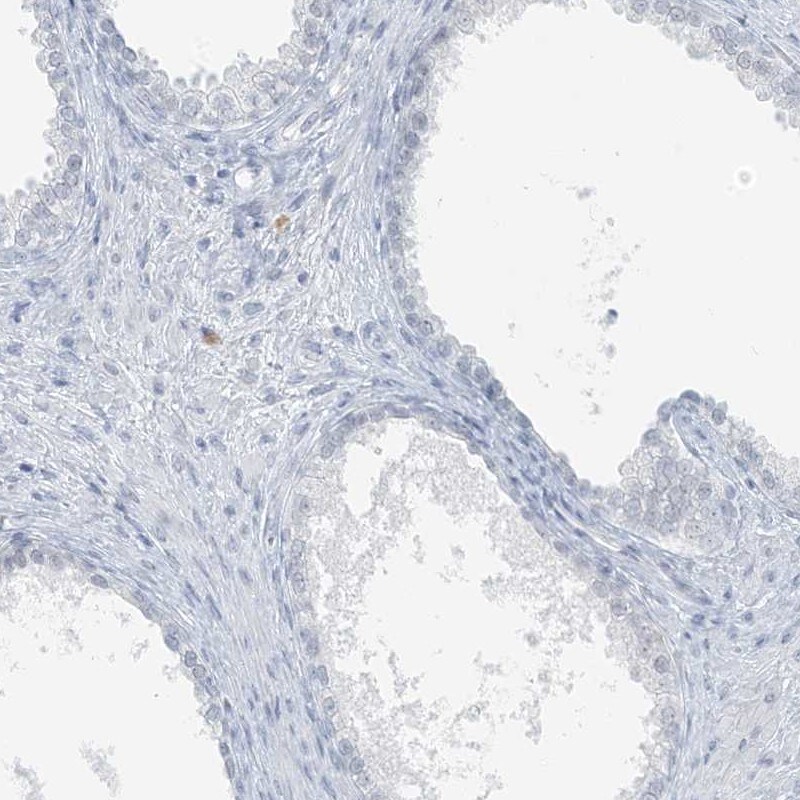 SCML1 Antibody - BSA Free Immunohistochemistry-Paraffin: SCML1 Antibody [NBP1-86309]