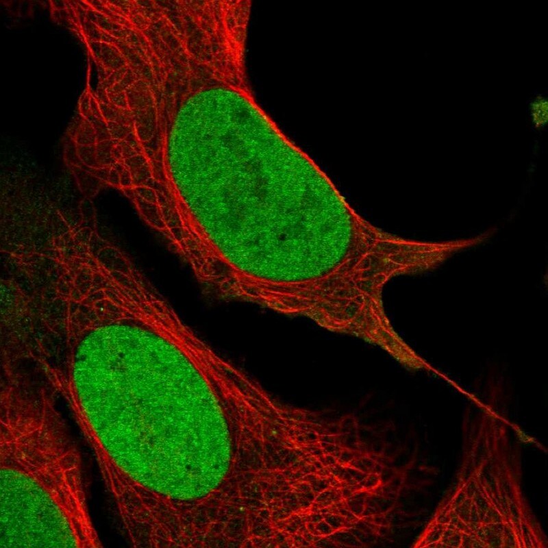 PCNP Antibody - BSA Free Immunohistochemistry-Paraffin: PCNP Antibody - BSA Free [NBP1-86312]