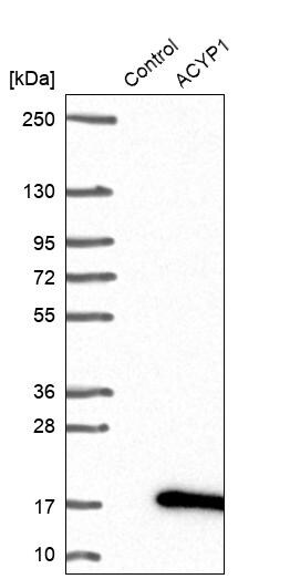 ACYP1 Antibody - BSA Free Western Blot: ACYP1 Antibody - BSA Free [NBP1-86314]
