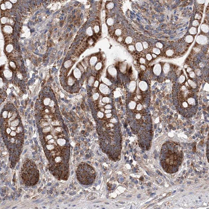 SDHAF4 Antibody - BSA Free Immunohistochemistry-Paraffin: SDHAF4 Antibody [NBP1-86324]