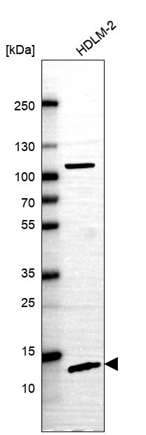 SDHAF4 Antibody - BSA Free Western Blot: SDHAF4 Antibody - BSA Free [NBP1-86324]