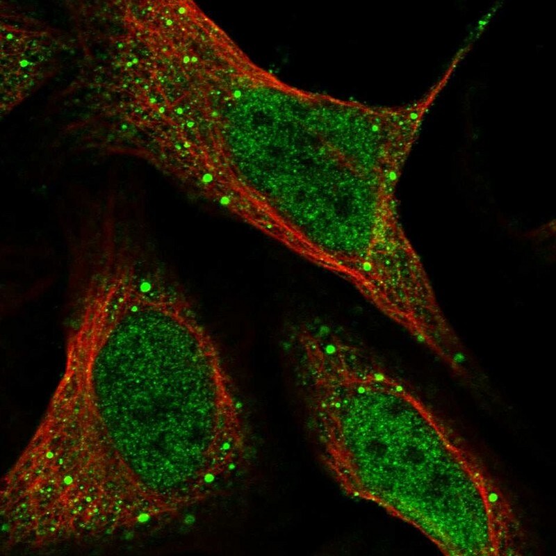 HHLA3 Antibody - BSA Free Immunocytochemistry/ Immunofluorescence: HHLA3 Antibody [NBP1-86331]