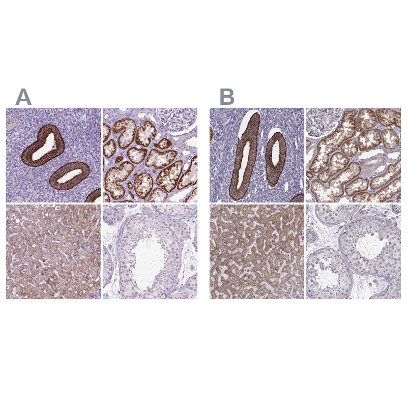 Kynurenine 3-Monooxygenase/KMO Antibody Immunohistochemistry-Paraffin: Kynurenine 3-Monooxygenase/KMO Antibody Antibody [NBP1-86335]