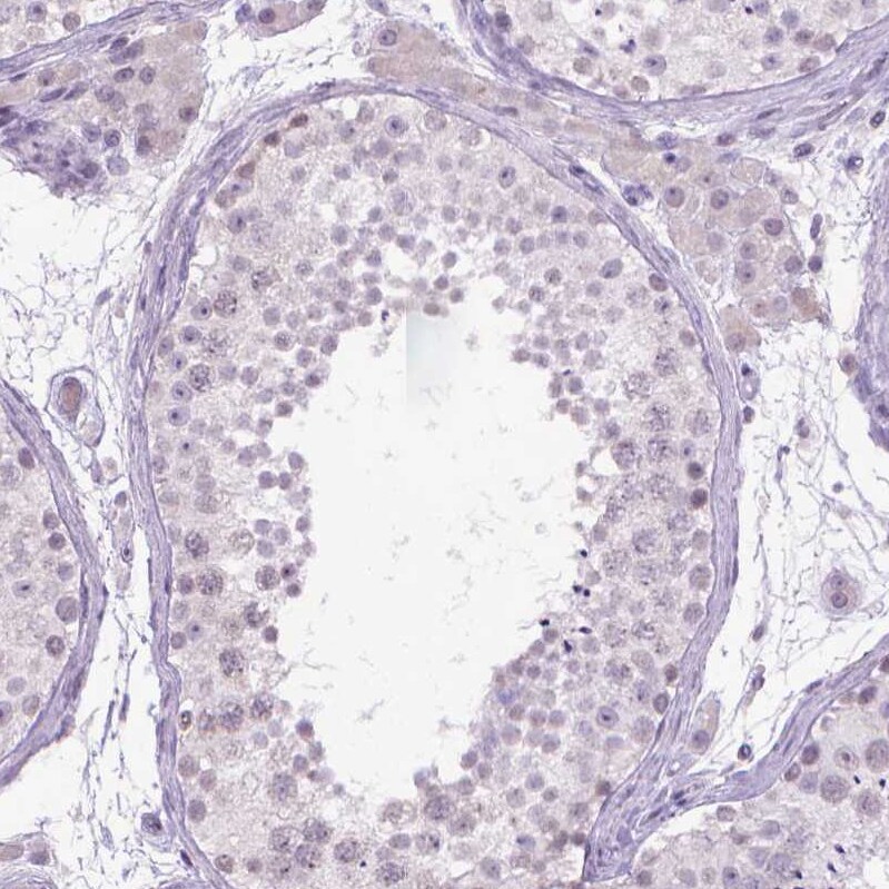 Kynurenine 3-Monooxygenase/KMO Antibody - BSA Free Immunohistochemistry-Paraffin: Kynurenine 3-Monooxygenase/KMO Antibody - BSA Free [NBP1-86335]