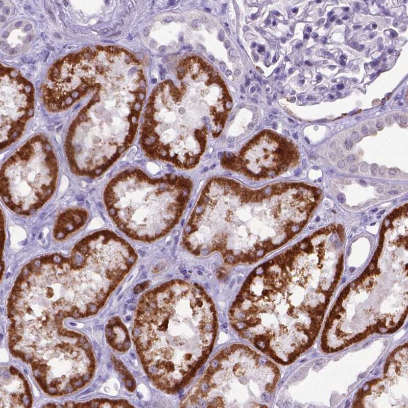 Kynurenine 3-Monooxygenase/KMO Antibody - BSA Free Immunohistochemistry-Paraffin: Kynurenine 3-Monooxygenase/KMO Antibody - BSA Free [NBP1-86335]