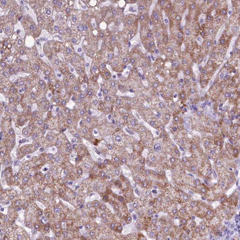 Kynurenine 3-Monooxygenase/KMO Antibody - BSA Free Immunohistochemistry-Paraffin: Kynurenine 3-Monooxygenase/KMO Antibody - BSA Free [NBP1-86335]