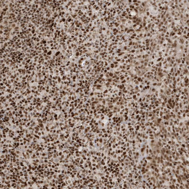 CKS2 Antibody - BSA Free Immunohistochemistry-Paraffin: CKS2 Antibody - BSA Free [NBP1-86336]