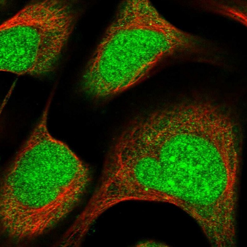 ZNF195 Antibody - BSA Free Immunocytochemistry/ Immunofluorescence: ZNF195 Antibody [NBP1-86338]