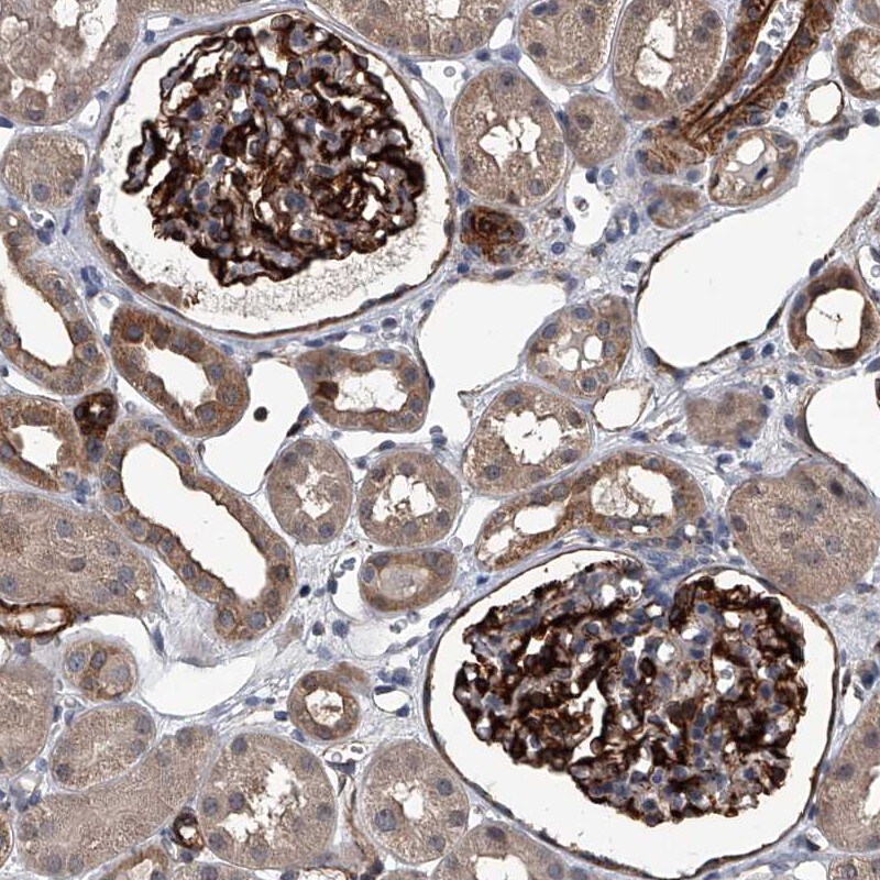 LDLRAD2 Antibody - BSA Free Immunohistochemistry: LDLRAD2 Antibody - BSA Free [NBP1-86339]