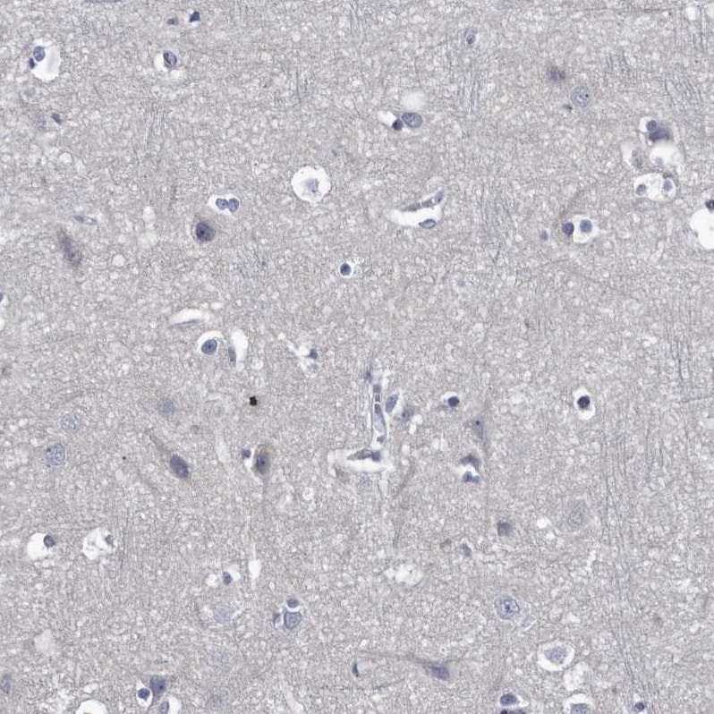 Prostasin/Prss8 Antibody - BSA Free Immunohistochemistry-Paraffin: Prostasin/Prss8 Antibody - BSA Free [NBP1-86340]