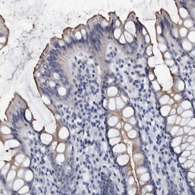 Prostasin/Prss8 Antibody - BSA Free Immunohistochemistry-Paraffin: Prostasin/Prss8 Antibody - BSA Free [NBP1-86340]