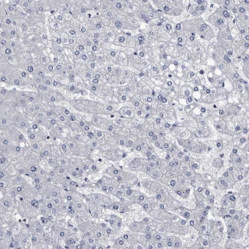 Prostasin/Prss8 Antibody - BSA Free Immunohistochemistry-Paraffin: Prostasin/Prss8 Antibody - BSA Free [NBP1-86340]