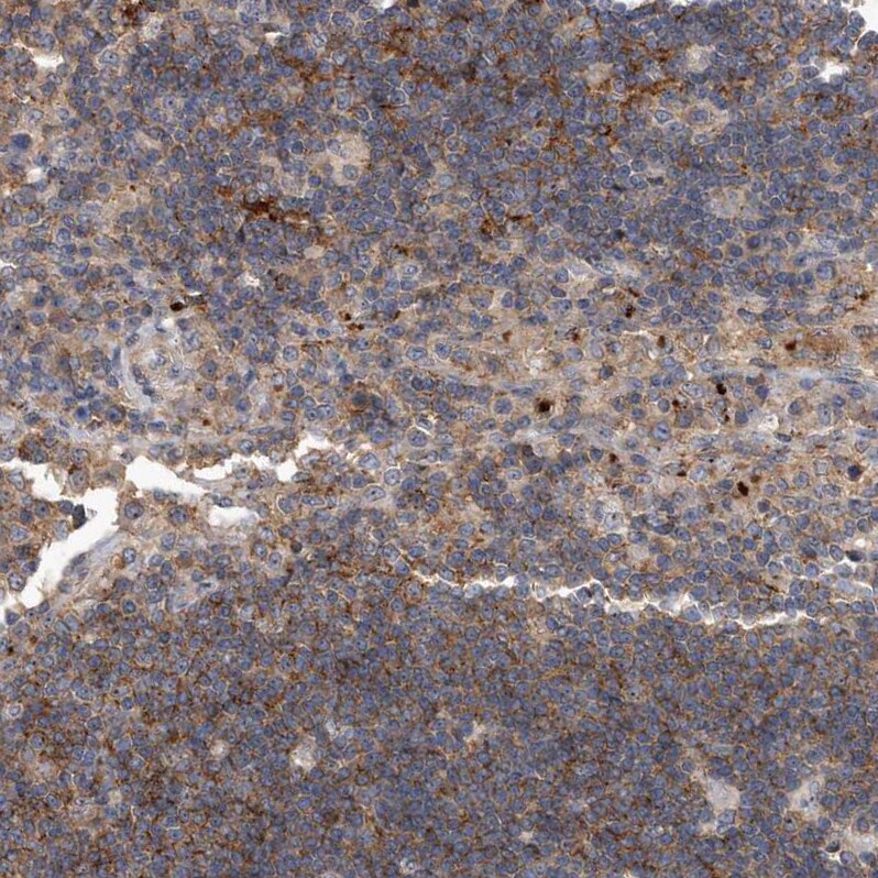 PGBD2 Antibody - BSA Free Immunohistochemistry-Paraffin: PGBD2 Antibody - BSA Free [NBP1-86348]