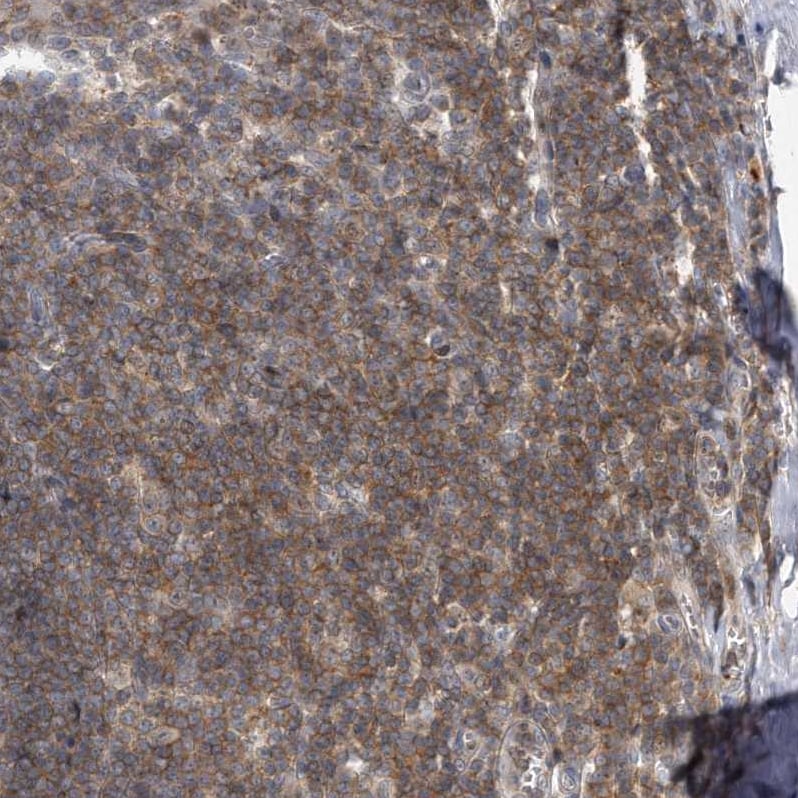 PGBD2 Antibody - BSA Free Immunohistochemistry-Paraffin: PGBD2 Antibody - BSA Free [NBP1-86349]